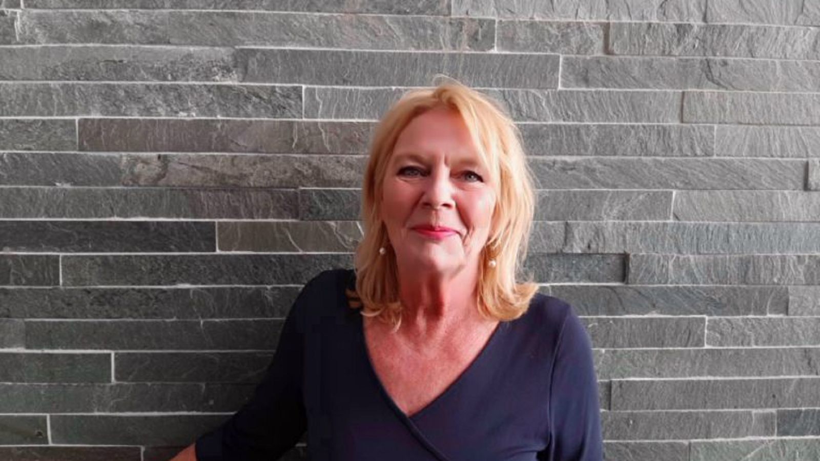 Mijn huidaandoening is een enorme zoektocht