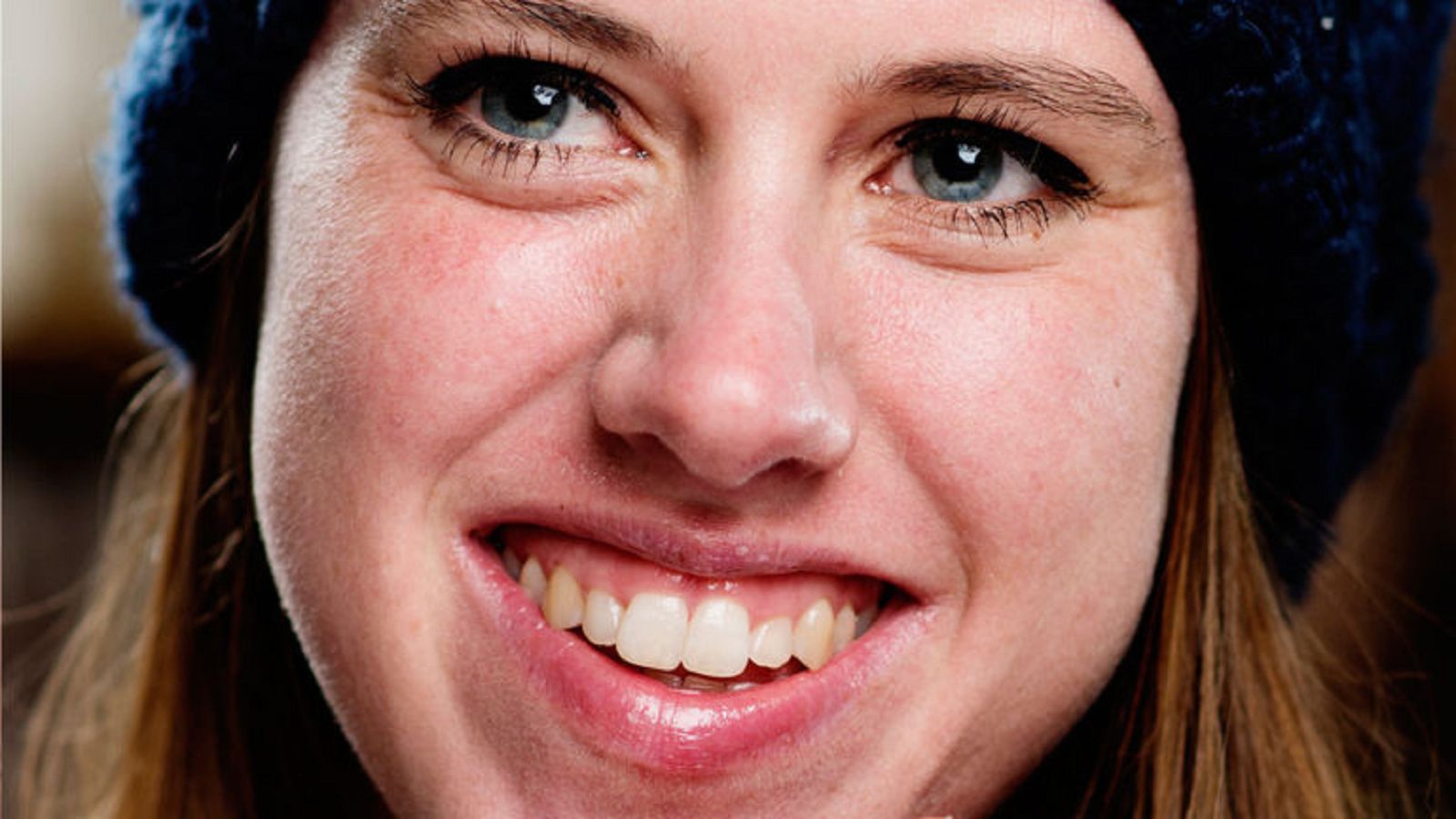 Ervaring met eczeem - het verhaal van Roos