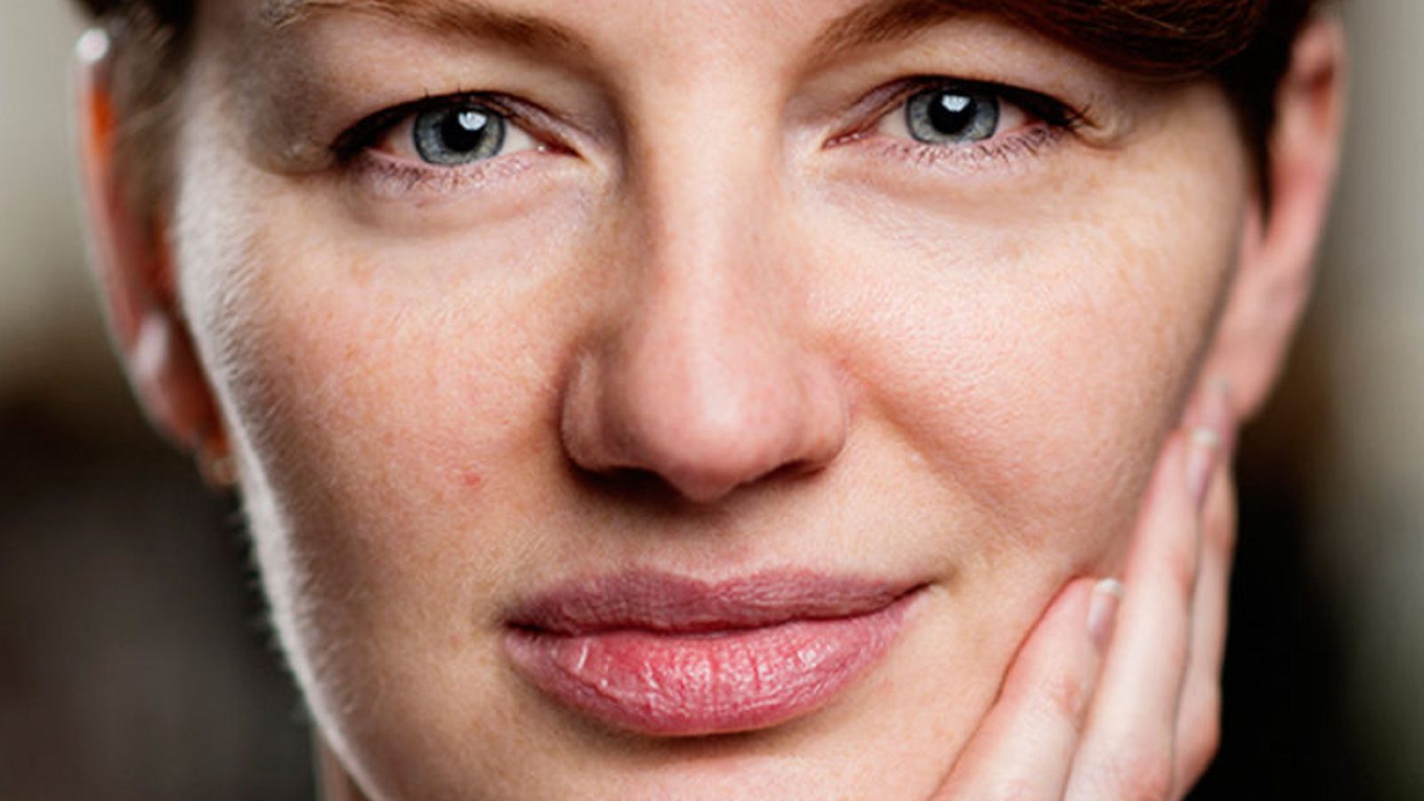 Ervaring met huidkanker, lees het verhaal van Monique