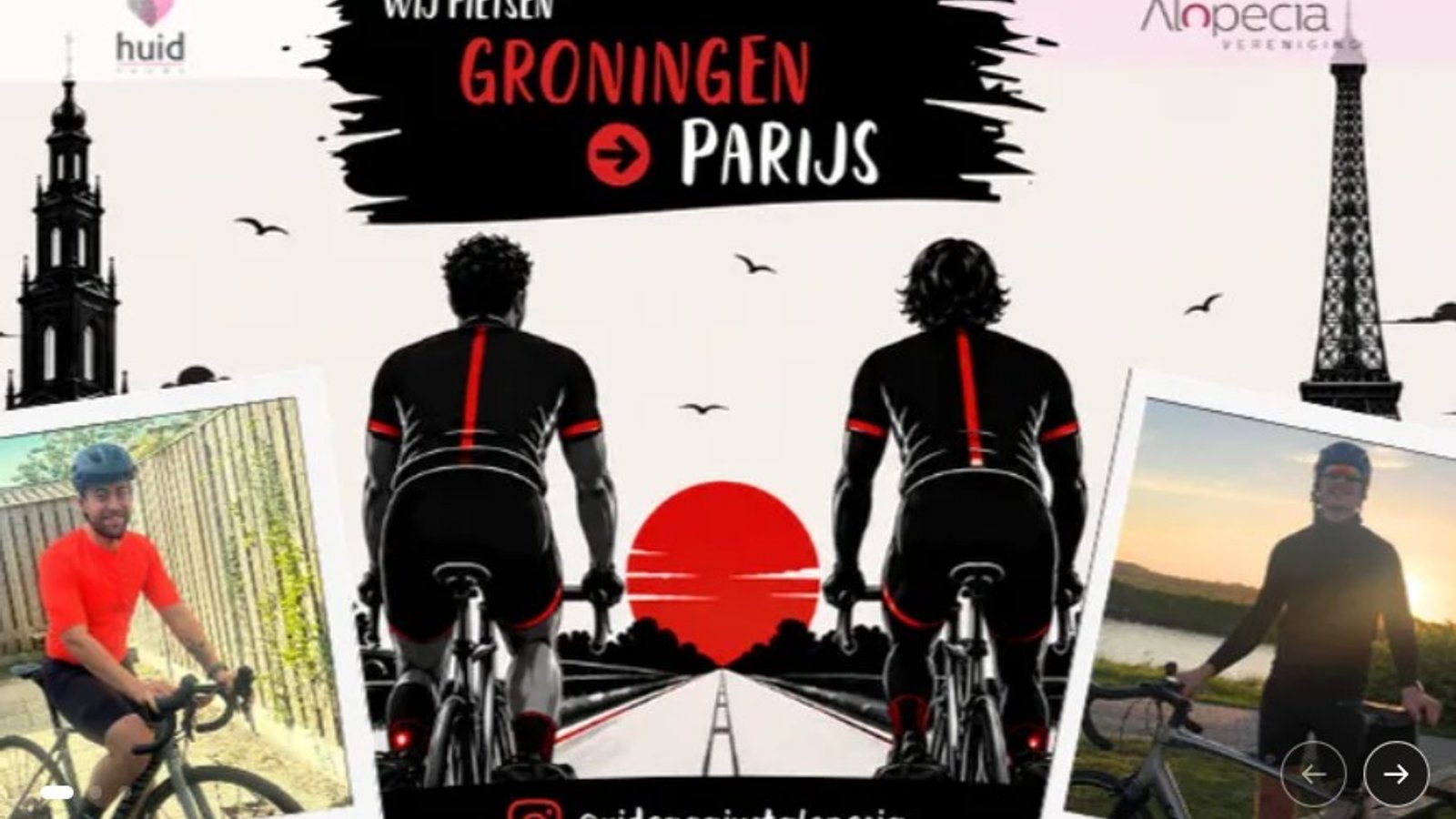 Van Groningen naar Parijs voor meer aandacht voor alopecia