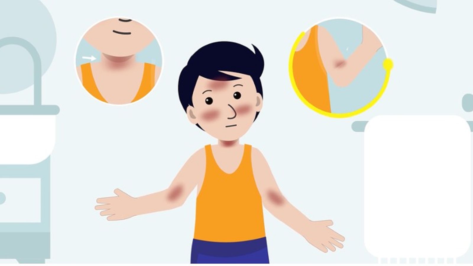 Smeerinstructie pimecrolimus