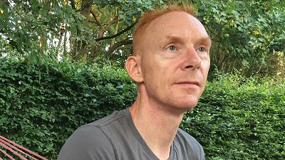 Ervaring met rosacea, het verhaal van Wilfried